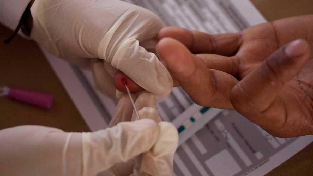 Acabar con el estigma del VIH, el primer paso para erradicar la enfermedad